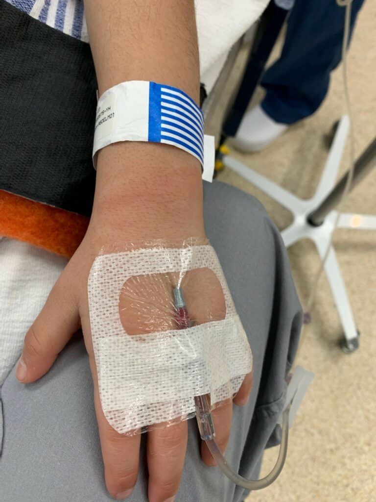 EMLA application, IV placement in the operating room and gauze hand wrap for IV security.