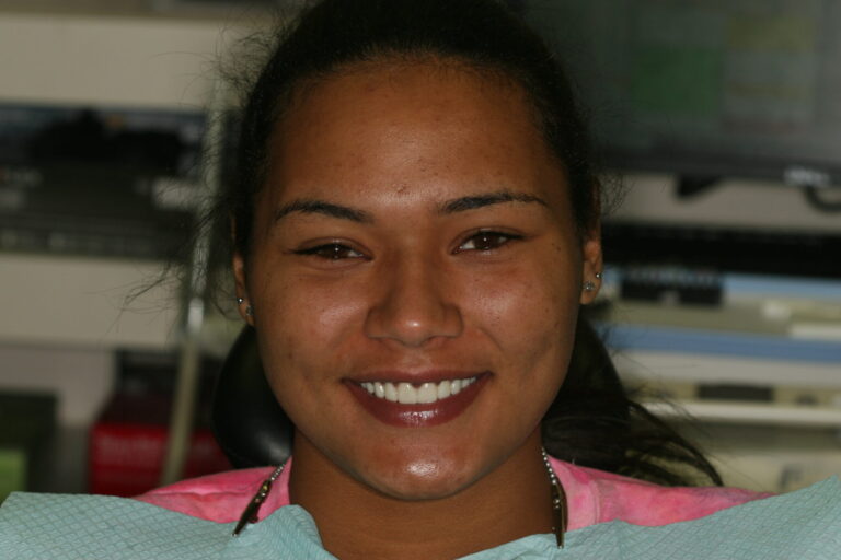Full face approved provisionals.