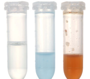 Left to right: a solution of sodium hypochlorite mixed with EDTA, a solution of 2% chlorhexidine mixed with EDTA, a solution of sodium hypochlorite mixed with 2% chlorhexidine