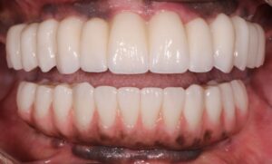 Frontal view of completed case. 