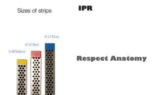  IPR using diamond non serrated strip.  