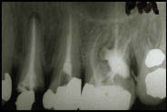 Figure 10-Post Mortem X-ray. Courtesy - Personal Files of Dr. Frank Stechey, Hamilton, Ontario.