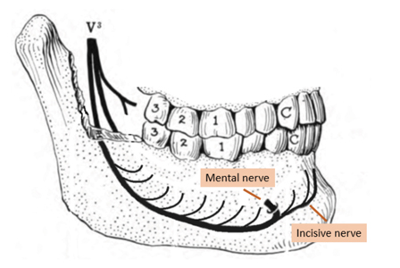 Pathway of the inferior alveolar nerve and branches.