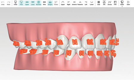 LightPlan Software.